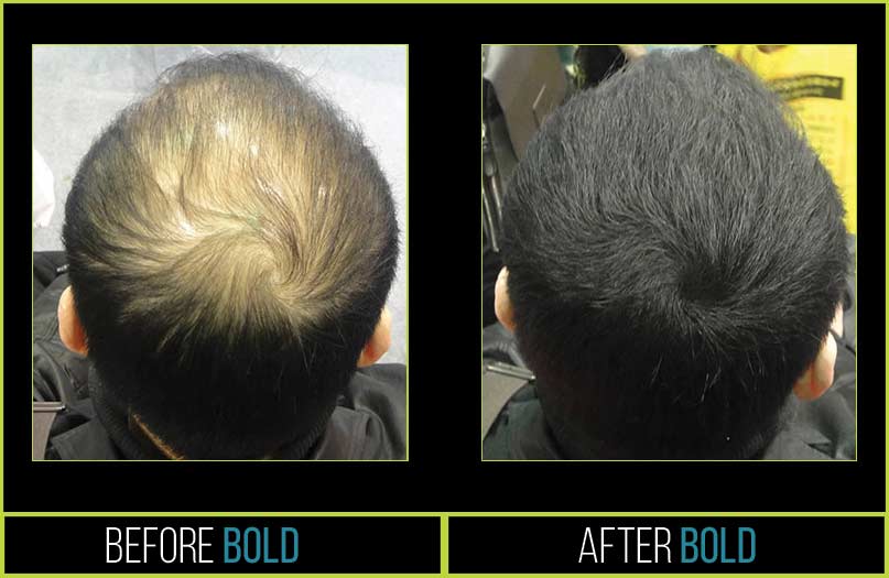 Bold-Products USA