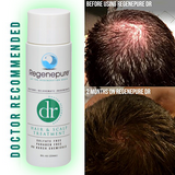 Regenepure DR Hair and Scalp Treatment